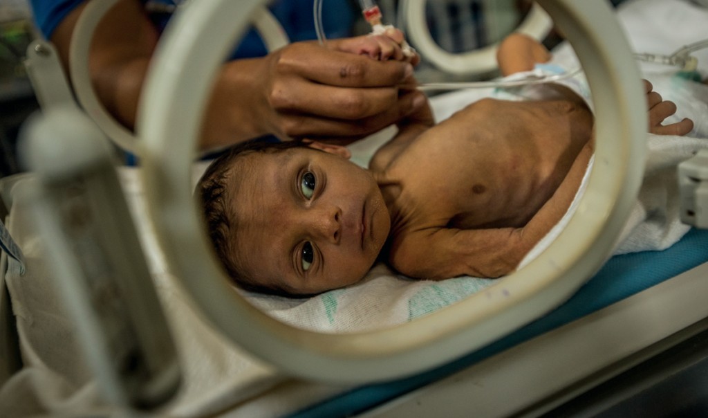 Millones de dólares desperdiciados en campaña de Nicolás Maduro mientras millones de niños venezolanos mueren de hambre Millones de dólares desperdiciados en campaña de Nicolás Maduro mientras millones de niños venezolanos mueren de hambre